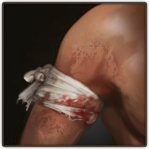 Possible illustration 2